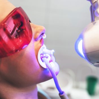things_dentists_wish_knew_about_teeth_whitening_slow_steady