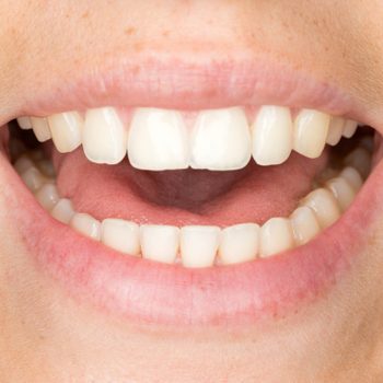 03_humid_now_youre_talking_5_tips_laryngitis_