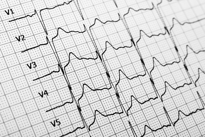 heart rate chart