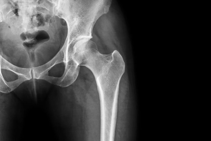 X-ray