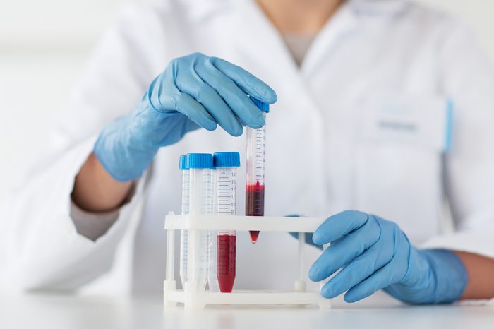Scientist holding tube with blood sample 