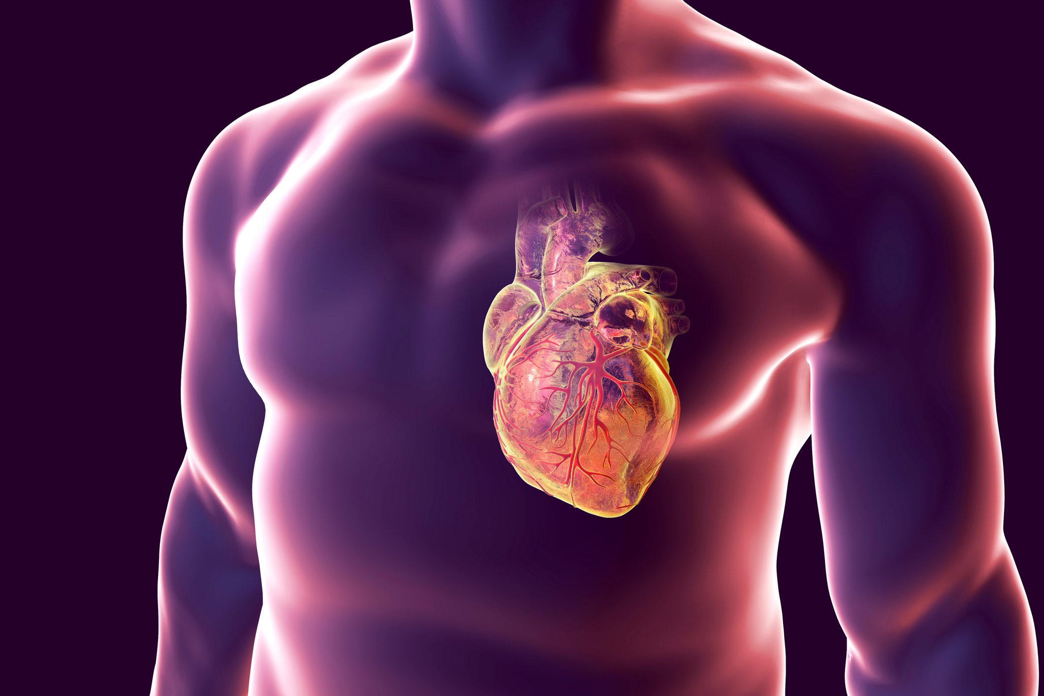 Heart attack, conceptual illustration