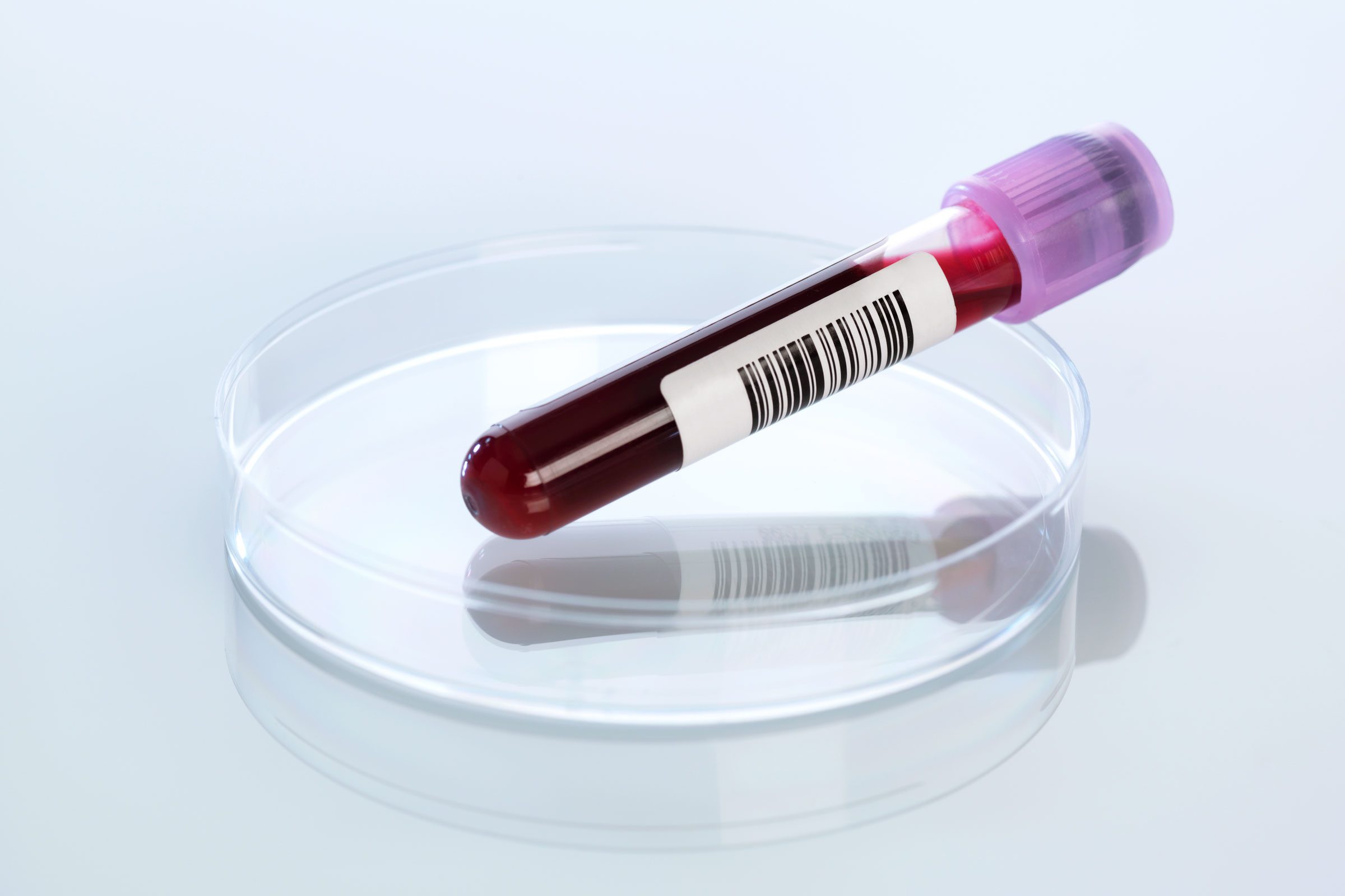 A Simple New Test Is Identifying Up to 100% of Early-Stage Cancer Cases